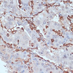 HLA-DRA Antibody