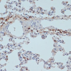 HLA-DRA Antibody