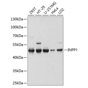 Western blot analysis of various lysates using INPP1 Antibody at 1/1000 dilution. Secondary antibody: HRP-conjugated Goat anti-Rabbit IgG (H+L) at 1/10000 dilution. Lysates/proteins: 25 µg per lane. Blocking buffer: 3% nonfat dry milk in TBST. Exposure time: 10s.