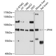 Western blot analysis of various lysates using JPH4 Antibody at 1/1000 dilution. Secondary antibody: HRP-conjugated Goat anti-Rabbit IgG (H+L) at 1/10000 dilution. Lysates/proteins: 25 µg per lane. Blocking buffer: 3% nonfat dry milk in TBST. Exposure time: 10s.