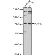 Western blot analysis of various lysates using KCNK10 Antibody at 1/3000 dilution. Secondary antibody: HRP-conjugated Goat anti-Rabbit IgG (H+L) at 1/10000 dilution. Lysates/proteins: 25 µg per lane. Blocking buffer: 3% nonfat dry milk in TBST. Exposure time: 90s.