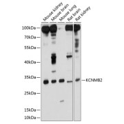 Western blot analysis of various lysates using KCNMB2 Antibody at 1/1000 dilution. Secondary antibody: HRP-conjugated Goat anti-Rabbit IgG (H+L) at 1/10000 dilution. Lysates/proteins: 25 µg per lane. Blocking buffer: 3% nonfat dry milk in TBST. Exposure time: 30s.