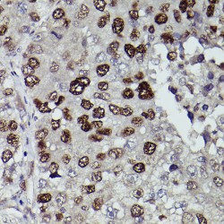 Lysine-Specific Demethylase 3A (KDM3A) Antibody