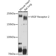 Western blot analysis of various lysates using VEGF Receptor 2 Antibody at 1/500 dilution. Secondary antibody: HRP-conjugated Goat anti-Rabbit IgG (H+L) at 1/10000 dilution. Lysates/proteins: 25 µg per lane. Blocking buffer: 3% nonfat dry milk in TBST. Exposure time: 10s.