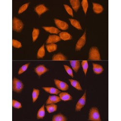 Lymphocyte Antigen 6 Complex Locus E (LY6E) Antibody