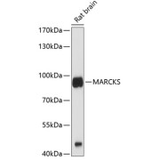 Western blot analysis of lysates from rat brain, using MARCKS Antibody at 1/1000 dilution. Secondary antibody: HRP-conjugated Goat anti-Rabbit IgG (H+L) at 1/10000 dilution. Lysates/proteins: 25 µg per lane. Blocking buffer: 3% nonfat dry milk in TBST. Exposure time: 30s.