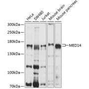 Western blot analysis of various lysates using MED14 Antibody at 1/1000 dilution. Secondary antibody: HRP-conjugated Goat anti-Rabbit IgG (H+L) at 1/10000 dilution. Lysates/proteins: 25 µg per lane. Blocking buffer: 3% nonfat dry milk in TBST. Exposure time: 5s.