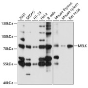 Western blot analysis of various lysates using MELK Antibody at 1/1000 dilution. Secondary antibody: HRP-conjugated Goat anti-Rabbit IgG (H+L) at 1/10000 dilution. Lysates/proteins: 25 µg per lane. Blocking buffer: 3% nonfat dry milk in TBST. Exposure time: 5s.