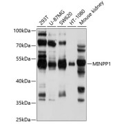 Western blot analysis of various lysates using MINPP1 Antibody at 1/1000 dilution. Secondary antibody: HRP-conjugated Goat anti-Rabbit IgG (H+L) at 1/10000 dilution. Lysates/proteins: 25 µg per lane. Blocking buffer: 3% nonfat dry milk in TBST. Exposure time: 10s.