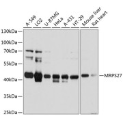 Western blot analysis of various lysates using MRPS27 Antibody at 1/3000 dilution. Secondary antibody: HRP-conjugated Goat anti-Rabbit IgG (H+L) at 1/10000 dilution. Lysates/proteins: 25 µg per lane. Blocking buffer: 3% nonfat dry milk in TBST. Exposure time: 3s.