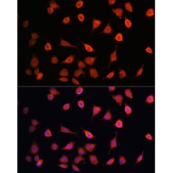 Mitochondrial Ribosomal Protein S27 (MRPS27) Antibody