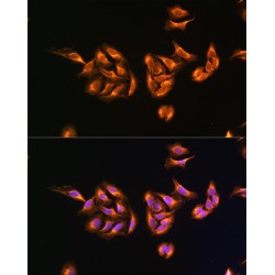 Mitochondrial Ribosomal Protein S27 (MRPS27) Antibody