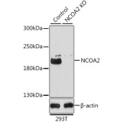 Western blot analysis of lysates from wild type (WT) and NCOA2 knockout (KO) 293T cells, using [KO Validated] NCOA2 Antibody at 1/1000 dilution. Secondary antibody: HRP-conjugated Goat anti-Rabbit IgG (H+L) at 1/10000 dilution. Lysates/proteins: 25 µg per lane. Blocking buffer: 3% nonfat dry milk in TBST. Exposure time: 3min.