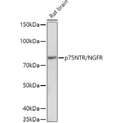 Nerve Growth Factor Receptor (NGFR) Antibody