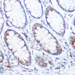 NODAL Modulator 1 (NOMO1) Antibody