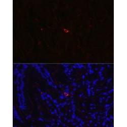 Neurotensin/neuromedin N (NTS) Antibody