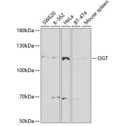 Western blot analysis of various lysates using OGT Antibody at 1/1000 dilution. Secondary antibody: HRP-conjugated Goat anti-Rabbit IgG (H+L) at 1/10000 dilution. Lysates/proteins: 25 µg per lane. Blocking buffer: 3% nonfat dry milk in TBST. Exposure time: 90s.