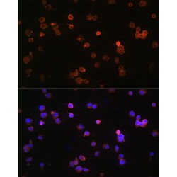 Purinergic Receptor P2X 5 (P2RX5) Antibody