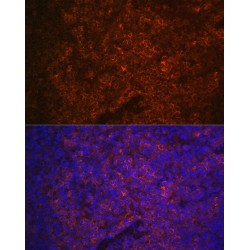 Purinergic Receptor P2X 5 (P2RX5) Antibody