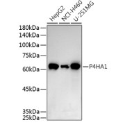 Western blot analysis of various lysates using P4HA1 Antibody at 1/500 dilution. Secondary antibody: HRP-conjugated Goat anti-Rabbit IgG (H+L) at 1/10000 dilution. Lysates/proteins: 25 µg per lane. Blocking buffer: 3% nonfat dry milk in TBST. Exposure time: 60s.