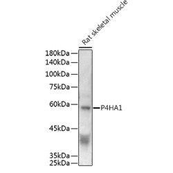 Prolyl 4-Hydroxylase Subunit Alpha-1 (P4HA1) Antibody