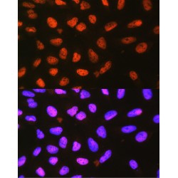 Prolyl 4-Hydroxylase Subunit Alpha-1 (P4HA1) Antibody