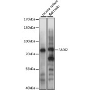 Western blot analysis of various lysates using PADI2 Antibody at 1/1000 dilution. Secondary antibody: HRP-conjugated Goat anti-Rabbit IgG (H+L) at 1/10000 dilution. Lysates/proteins: 25 µg per lane. Blocking buffer: 3% nonfat dry milk in TBST. Exposure time: 3s.