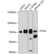 Western blot analysis of various lysates using POLK Antibody at 1/1000 dilution. Secondary antibody: HRP-conjugated Goat anti-Rabbit IgG (H+L) at 1/10000 dilution. Lysates/proteins: 25 µg per lane. Blocking buffer: 3% nonfat dry milk in TBST. Exposure time: 5s.