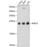 Western blot analysis of various lysates using RAB13 Antibody at 1/1000 dilution. Secondary antibody: HRP-conjugated Goat anti-Rabbit IgG (H+L) at 1/10000 dilution. Lysates/proteins: 25 µg per lane. Blocking buffer: 3% nonfat dry milk in TBST. Exposure time: 1s.