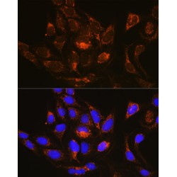 Ras-Related Protein Rab-13 (RAB13) Antibody