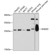 Western blot analysis of various lysates using RAB3D Antibody at 1/1000 dilution. Secondary antibody: HRP-conjugated Goat anti-Rabbit IgG (H+L) at 1/10000 dilution. Lysates/proteins: 25 µg per lane. Blocking buffer: 3% nonfat dry milk in TBST. Exposure time: 30s.