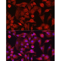 RAS Guanyl-Releasing Protein 1 (RASGRP1) Antibody