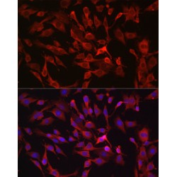 RAS Guanyl-Releasing Protein 1 (RASGRP1) Antibody