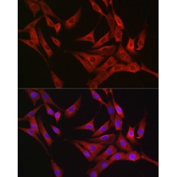 RAS Guanyl-Releasing Protein 1 (RASGRP1) Antibody