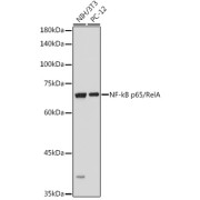 Western blot analysis of various lysates using NF-kB p65/RelA Antibody at 1/1000 dilution. Secondary antibody: HRP-conjugated Goat anti-Rabbit IgG (H+L) at 1/10000 dilution. Lysates/proteins: 25 µg per lane. Blocking buffer: 3% nonfat dry milk in TBST. Exposure time: 1s.