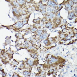 Transcription Factor p65 / NFKB3 (RELA) Antibody