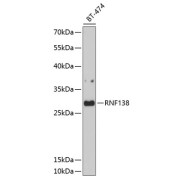 Western blot analysis of lysates from BT-474 cells, using RNF138 Antibody at 1/1000 dilution. Secondary antibody: HRP-conjugated Goat anti-Rabbit IgG (H+L) at 1/10000 dilution. Lysates/proteins: 25 µg per lane. Blocking buffer: 3% nonfat dry milk in TBST. Exposure time: 90s.