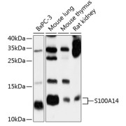 Western blot analysis of various lysates using S100A14 Antibody at 1/1000 dilution. Secondary antibody: HRP-conjugated Goat anti-Rabbit IgG (H+L) at 1/10000 dilution. Lysates/proteins: 25 µg per lane. Blocking buffer: 3% nonfat dry milk in TBST. Exposure time: 30s.