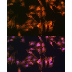 S100 Calcium Binding Protein A14 (S100A14) Antibody