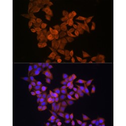 S100 Calcium Binding Protein A14 (S100A14) Antibody