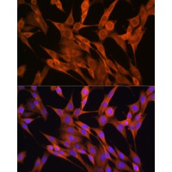 S100 Calcium Binding Protein A14 (S100A14) Antibody