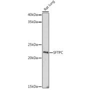 Western blot analysis of lysates from Rat lung, using SFTPC Antibody at 1/1000 dilution. Secondary antibody: HRP-conjugated Goat anti-Rabbit IgG (H+L) at 1/10000 dilution. Lysates/proteins: 25 µg per lane. Blocking buffer: 3% nonfat dry milk in TBST. Exposure time: 180s.