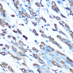 Natural Resistance-Associated Macrophage Protein 2 (SLC11A2) Antibody