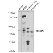 Western blot analysis of various lysates using SLC44A4 Antibody at 1/1000 dilution. Secondary antibody: HRP-conjugated Goat anti-Rabbit IgG (H+L) at 1/10000 dilution. Lysates/proteins: 25 µg per lane. Blocking buffer: 3% nonfat dry milk in TBST. Exposure time: 5s.