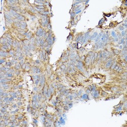 Sodium/calcium Exchanger 1 (SLC8A1) Antibody