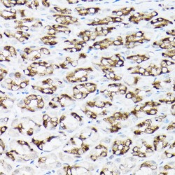 Sodium/calcium Exchanger 1 (SLC8A1) Antibody