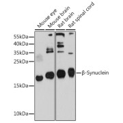 Western blot analysis of various lysates using β-Synuclein Antibody at 1/1000 dilution. Secondary antibody: HRP-conjugated Goat anti-Rabbit IgG (H+L) at 1/10000 dilution. Lysates/proteins: 25 µg per lane. Blocking buffer: 3% nonfat dry milk in TBST. Exposure time: 30s.