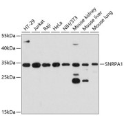 Western blot analysis of various lysates using SNRPA1 Antibody at 1/3000 dilution. Secondary antibody: HRP-conjugated Goat anti-Rabbit IgG (H+L) at 1/10000 dilution. Lysates/proteins: 25 µg per lane. Blocking buffer: 3% nonfat dry milk in TBST. Exposure time: 10s.