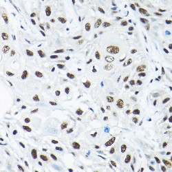 Small Nuclear Ribonucleoprotein Polypeptide A' (SNRPA1) Antibody