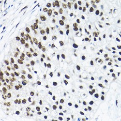 Small Nuclear Ribonucleoprotein Polypeptide A' (SNRPA1) Antibody